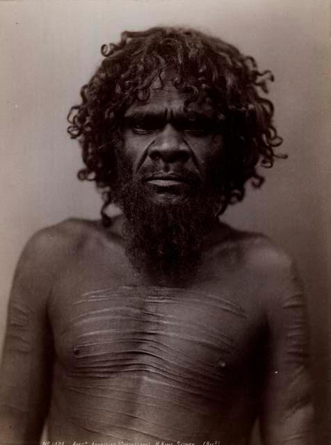 Studio portrait of an Aboriginal Woman of Queensland, Ritual Scarification  on her Arms and Abdomen – Objects – eMuseum