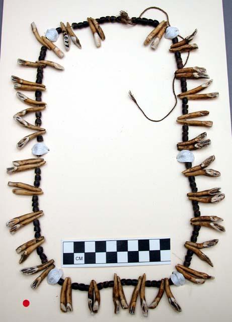 Necklace of seeds and teeth