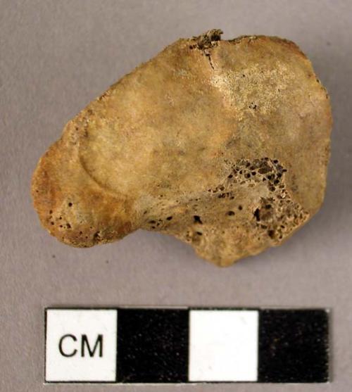 Bone, unidentified