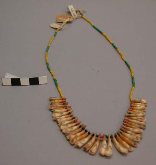 Girl's dog tooth necklace, also yellow and green beads