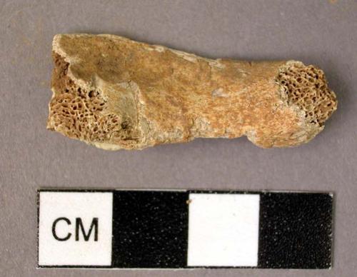 Bone, unidentified