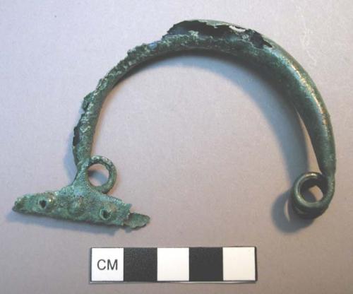 Fibula, 2-loop