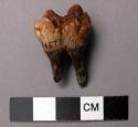 Large molar