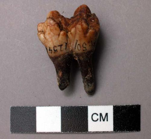 Large molar