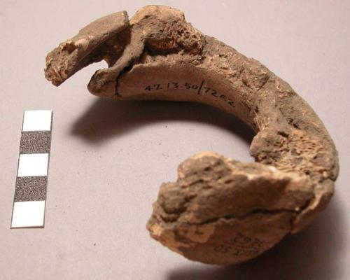 Pelvis bracelet found in position at armbone