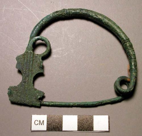 Fibula, 2-loop