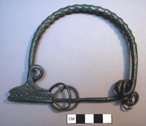 Fibula, 2-loop