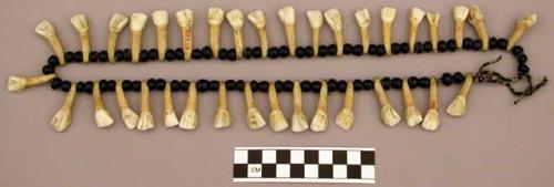 Necklace of beads and (deer?) teeth; horse tooth necklace