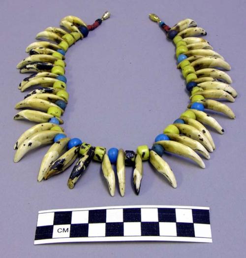 Glass bead and teeth necklace