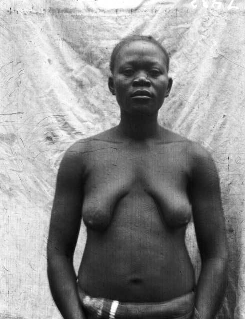 Abanzima woman