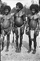 Three Men in loin cloths two with distended stomachs