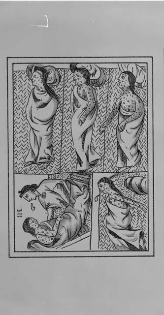 Sketch showing smallpox victims from Sahaguin, Bernardino de Historia General de las Cosas de Nueva Espana. Mexico 1829 Vol. IV, Libro XII, Pl. 114.