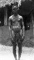 Scarification. Man with scars, Buzi, Mende