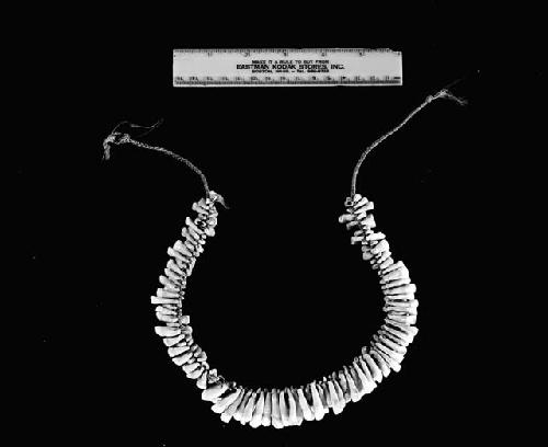 Necklace of human teeth