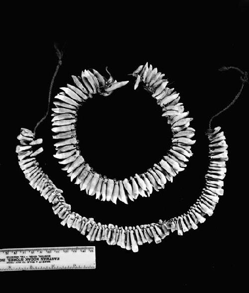 Two necklaces, one of human teeth and one of dolphin teeth