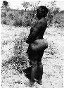 "61-5-23": Woman standing, showing her scarification