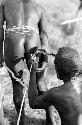 Karl Heider negatives, New Guinea; Yai-i removes an arrow from the buttock of a warrior