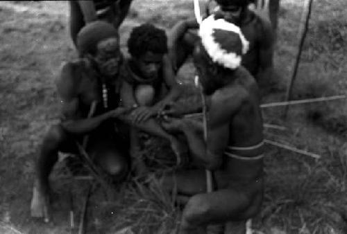 Arrow being pulled from boy's forearm