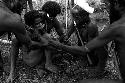 Arrow being pulled from boy's forearm