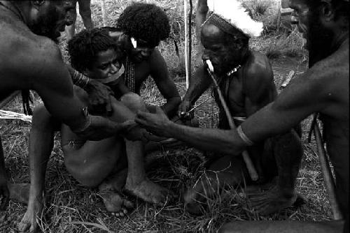 Arrow being pulled from boy's forearm