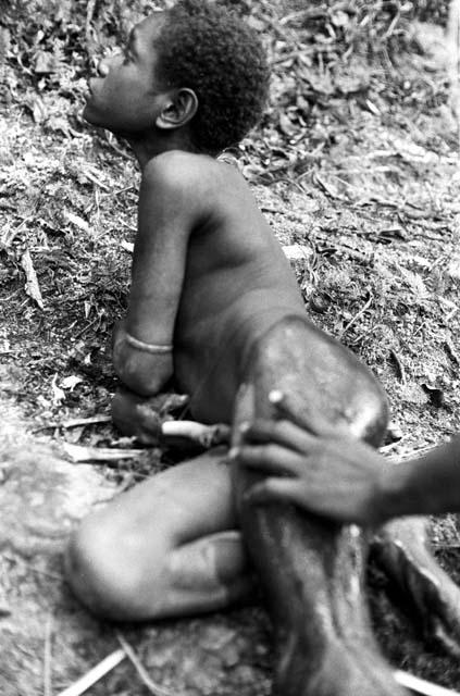 A man removing a large stick from Lokopma's leg