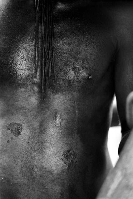 The wounds on Yege Asuk's stomach