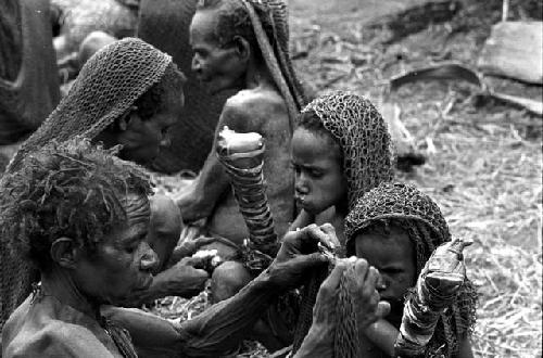 2 of the little girls and the women around them; hands all bandaged after having their fingers chopped off