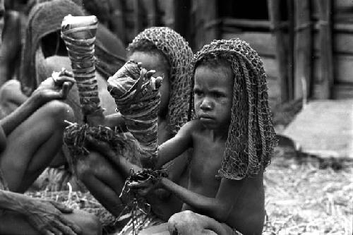 2 of the little girls and the women around them; hands all bandaged after having their fingers chopped off; they catch the blood with grass held in their other hand