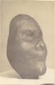Cast of human face. Supposed to be that of mound builder