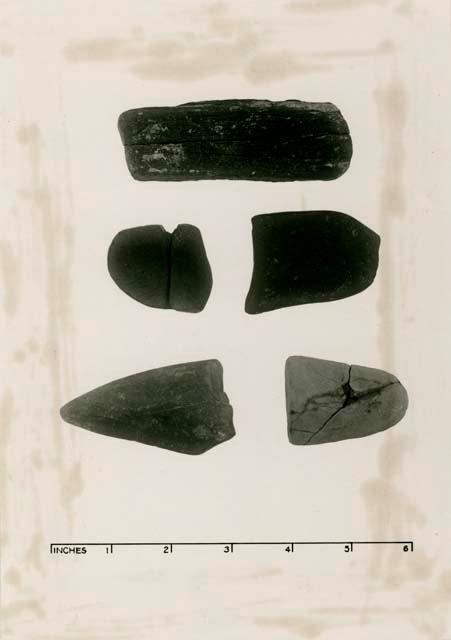 Lumps of pigment stones