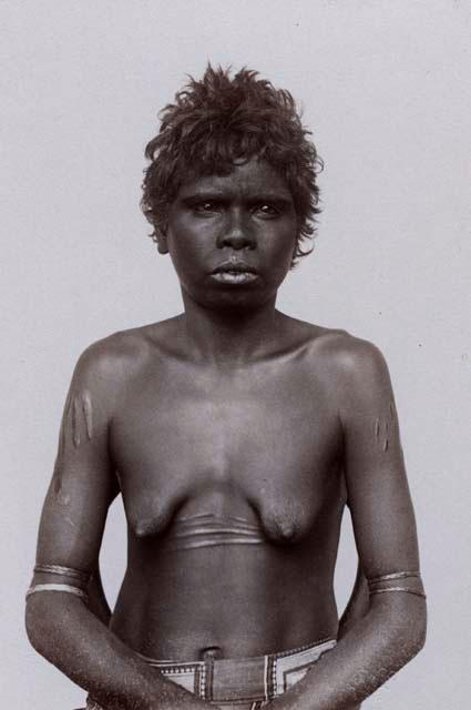 Studio portrait of an Aboriginal Woman of Queensland, Ritual Scarification on her Arms and Abdomen