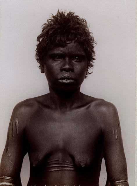 Studio portrait of an Aboriginal Woman of Queensland, Ritual Scarification on her Arms and Abdomen