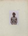 Studio portrait of an Aboriginal Woman of Queensland, Ritual Scarification  on her Arms and Abdomen – Objects – eMuseum