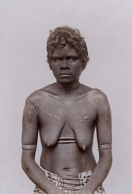 Studio portrait of an Aboriginal Woman of Queensland, Ritual Scarification on her Arms and Abdomen