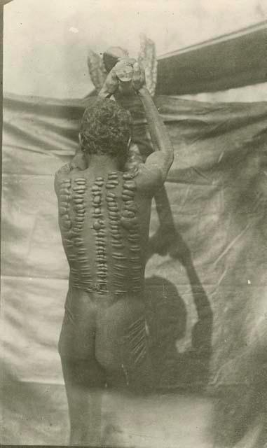 Aboriginal man, photographed from behind, with cicatrised back