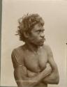 Portrait of an Aboriginal man from the Miccoolin Tribe, showing ritual scarification on his upper body
