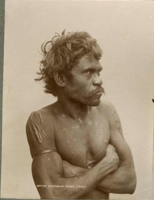 Portrait of an Aboriginal man from the Miccoolin Tribe, showing ritual scarification on his upper body