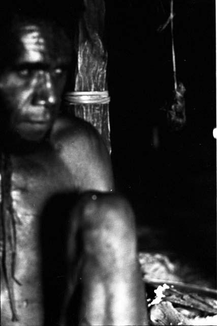 Tuessiké sitting in honai the day after he was wounded in the salek led by Tegé Warek