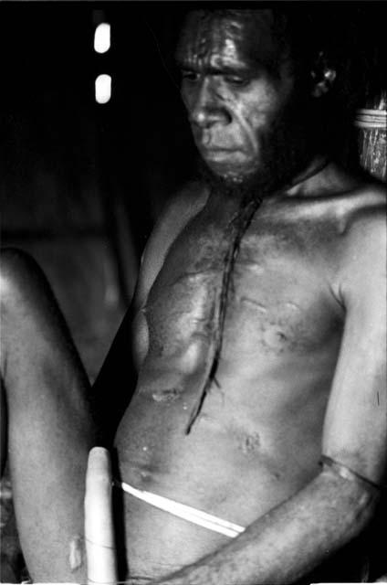 Tuessiké sitting in honai the day after he was wounded in the salek led by Tegé Warek