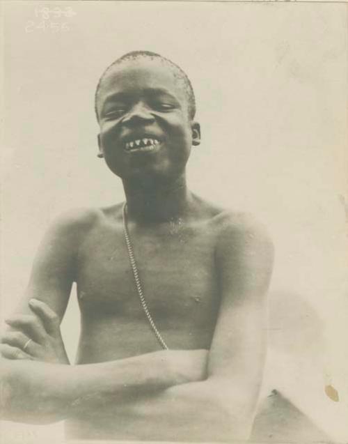 Boy with filed incisors