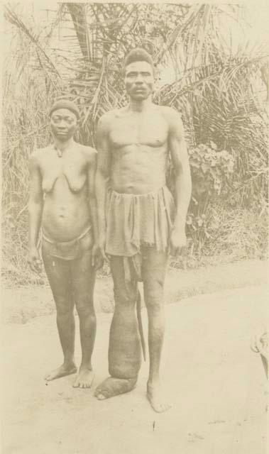 Woman and man standing, man has enlarged leg