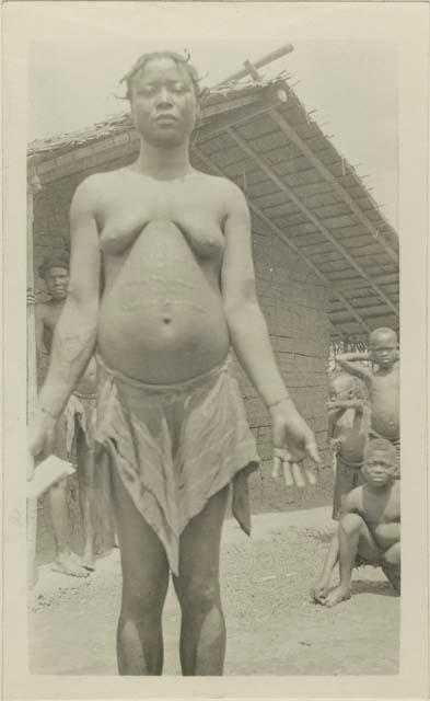 Woman with scarification