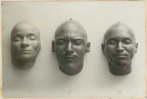 Facial casts