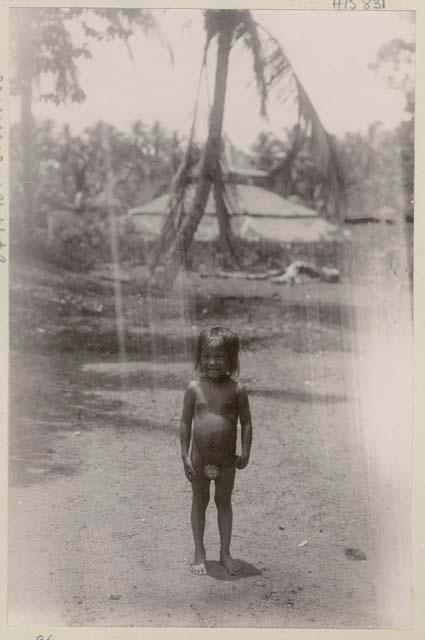 Child standing outside