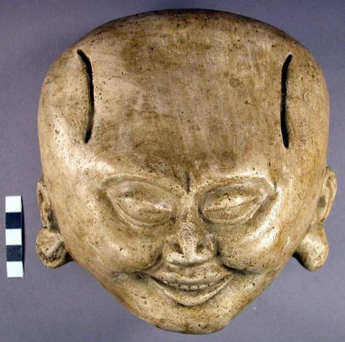 Cast of "laughing face" - incised line on each side of high forehead