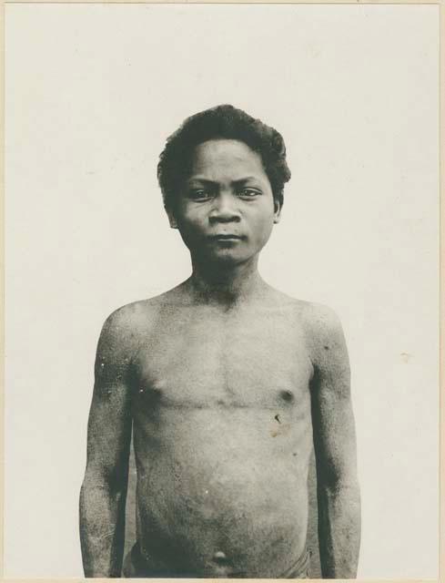 Man with skin condition