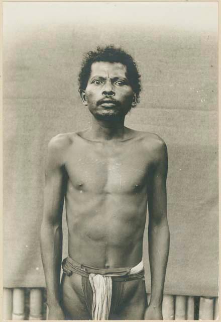 Man from Zambales Province with scar patterns on chest