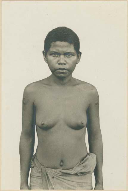 Woman from Zambales Province with scars on arm