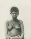 Woman with skin condition