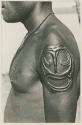 Man's shoulder with scarification